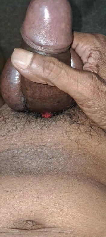 Maddymissile: ペニスへの自己愛