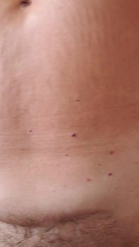 My Body