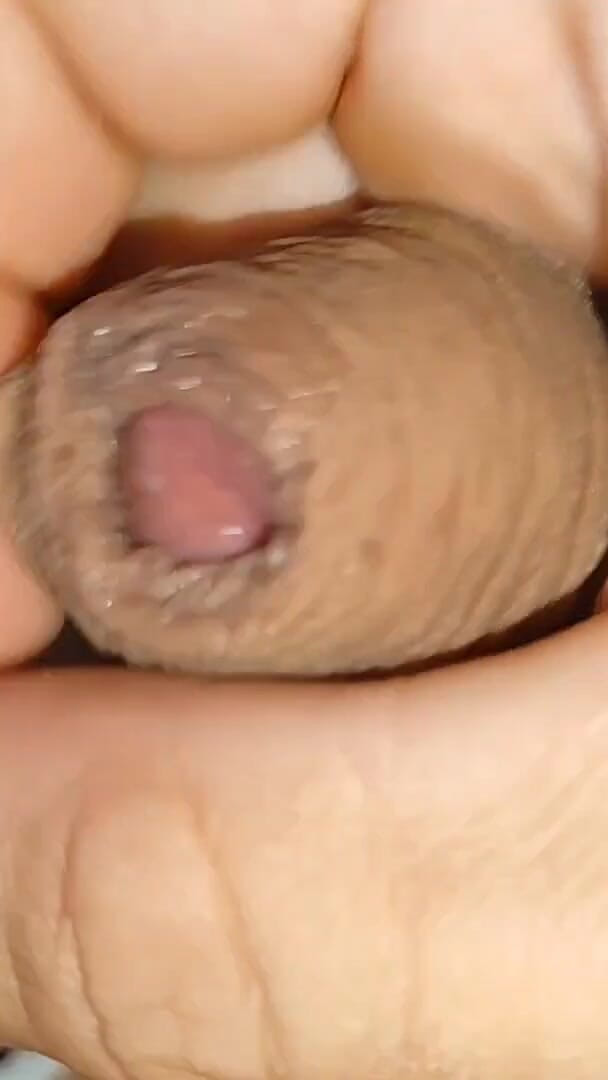 Cumshot of the Largest Phimosis Foreskin in the World. (Straight Daddy Club)