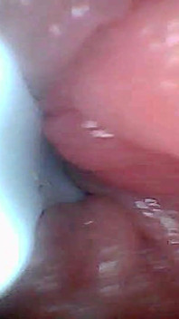 Panduan Visual untuk Perspektif Endoscop Stimulasi dan Orgasme G-spot