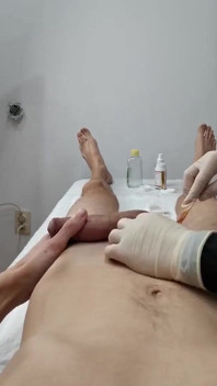 Kekurangan zakar berdenyut, bengkak. The Cosmetologist Keliru.