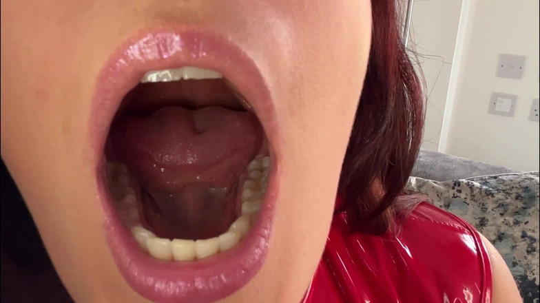 CALLIE ROKS: PVC口腔検査