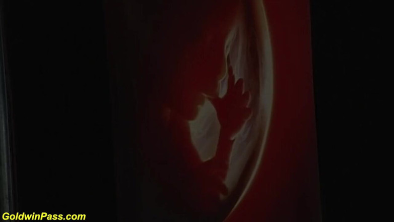 Goldwin pass: Ả điếm gầy dễ thương có lông được bác sĩ móc cua...