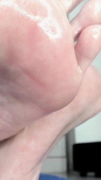 Piedi oleosi