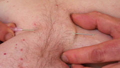 Qualzucht: Nur einige Nadeln ...