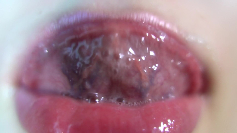 Rarible Diamond: リップス・オーバー・ユー・カスタム