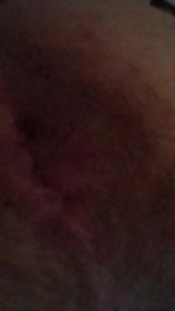 Pulse Ass