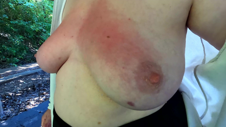 Bouncy Tits Action: Červené a oteklé kozy na veřejném grilu