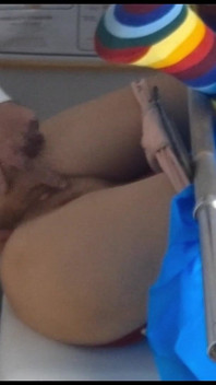 Gynekolog nemohl vznést vagínu pacienta!