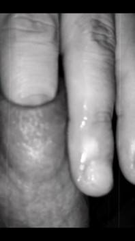 Foreskin Play