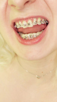 Eating in Braces, Food Fetish Video Devour