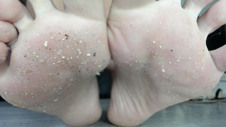 Feet lady: Toenails sujas e naturais