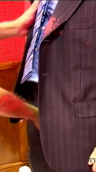 Röd hand