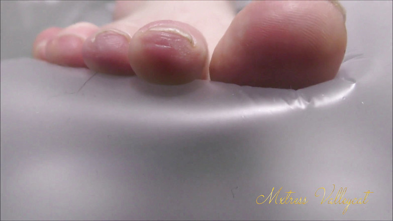 Mxtress Valleycat: 治疗包装弹出