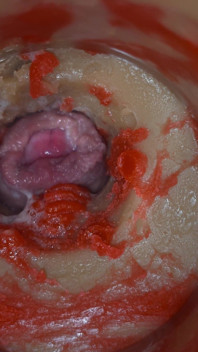 Insemination - Internal Camera Captures Deep Male Ejaculation
