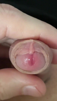 작은 포킨 페니스