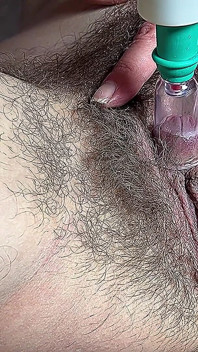 Hairy Mommy Clitoris Pumping,very Hot