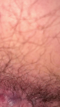 Close up Ass