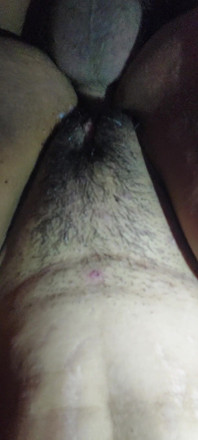 I Ate the Ass and Ass Totally of an Excited