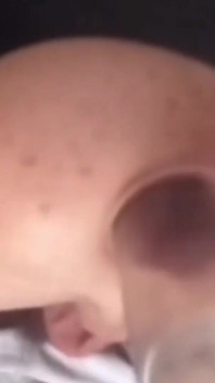 Anal Tears Part Three
