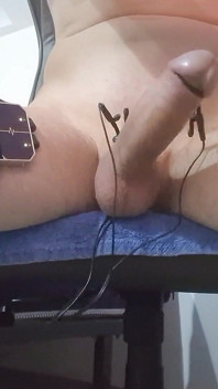 E-stim Hfo