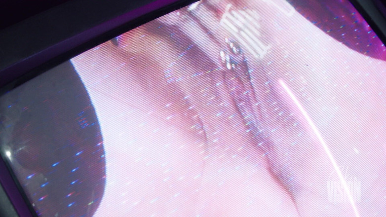 SkinVision: Iepuraș roz și suculent - Luna Luxxx
