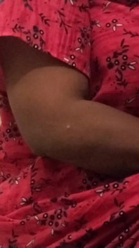 Hot Leg