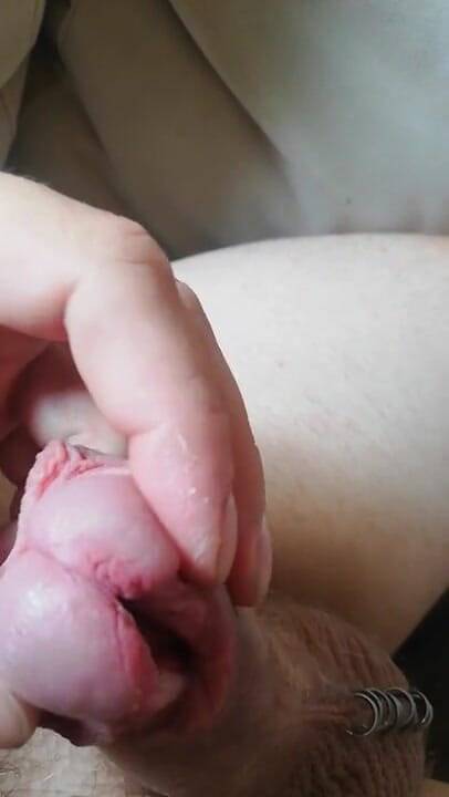 Cock split, subincision: Pik splijten met subincisie