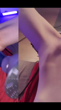 Double Camera View