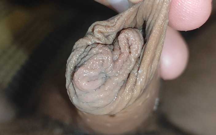 Straight Daddy Club: Staccando Lentamente Il Prepuzio Dal Glande.