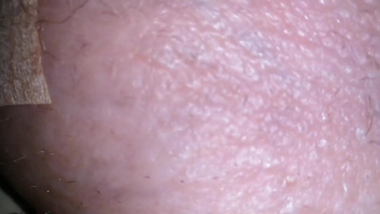 Monster_Meat_: Carne gonfia oscura riempita di silicone
