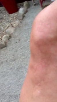 Şişman Yaşlı Karın