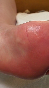 Look in Silence: My Foot and Massage