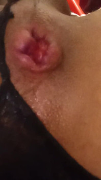My Little Ass Hole