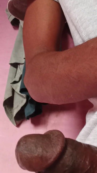 Small Penis