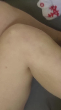 Overview of My Body