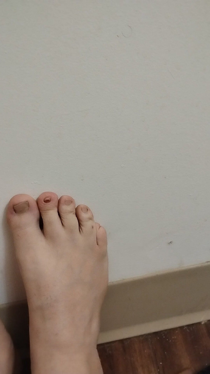 JG Risk: 11-26-2025 Roztomilé malé prsty