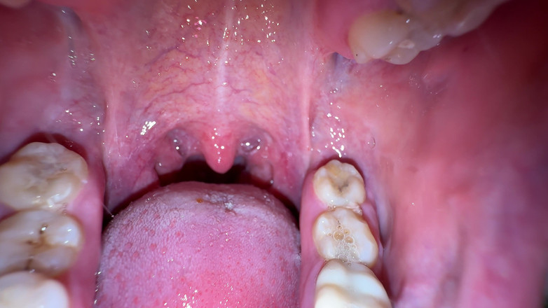 Hottie goddess: Ústa tajemství: tlustý bílý lak na mém jazyku