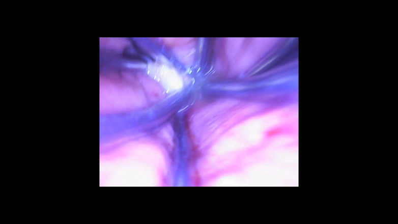 Fetish Bear Productions: Speculum &amp; Microcamera for Lady Soniac