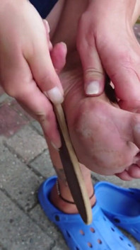 Soin des pieds en plein air sur le pied gauche