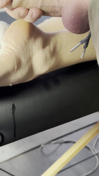 The Lollipop Couldn’t Handle the Pressure