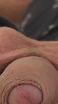 Large Foreskin and Balls in Striking Close-up.