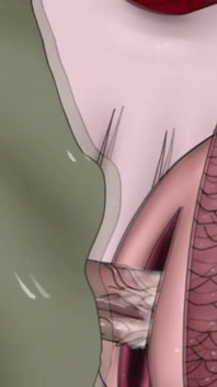 Shirahoshi (one Piece Kuso)