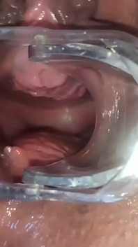 Masturbação com visão do útero e espéculo médico, close-up da minha buceta