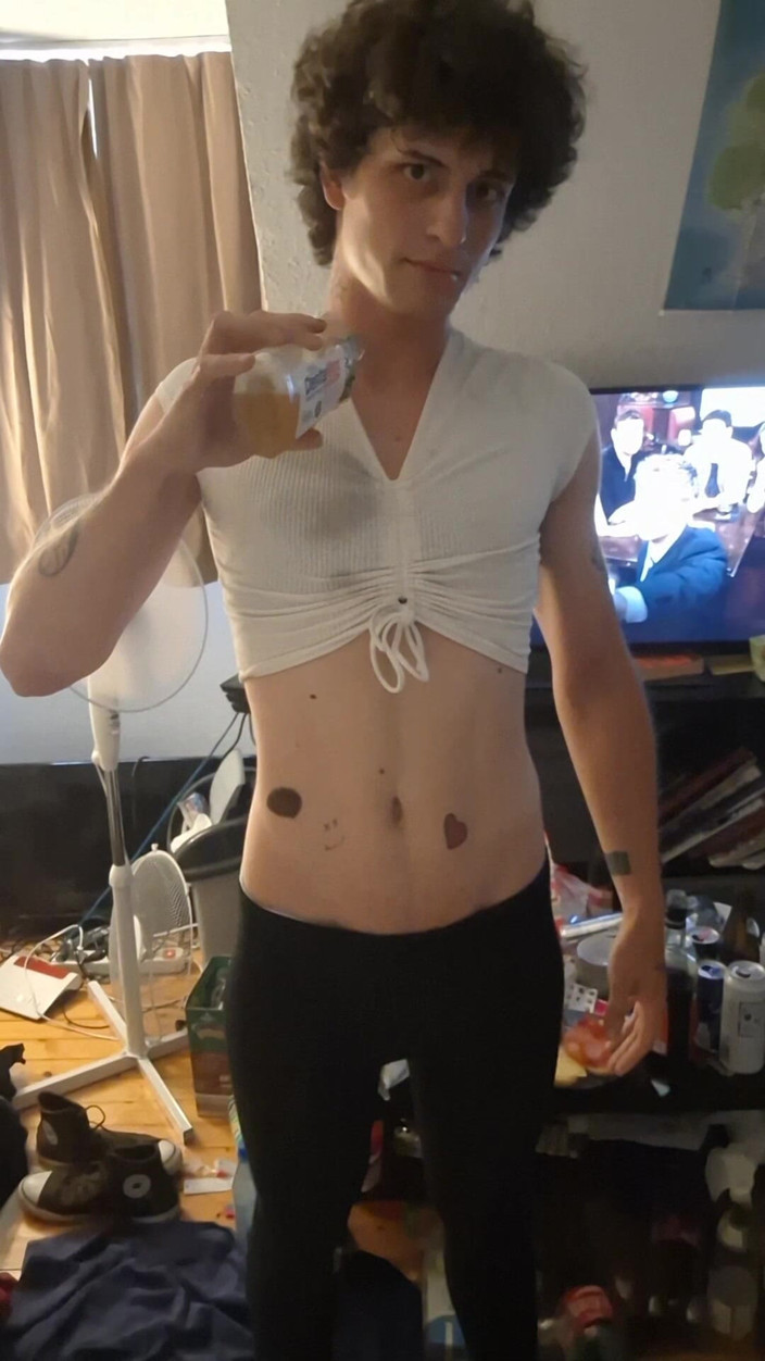 Josielove: Nejprve jsem si zničil zadek a pak škádlím vlastní chcaní