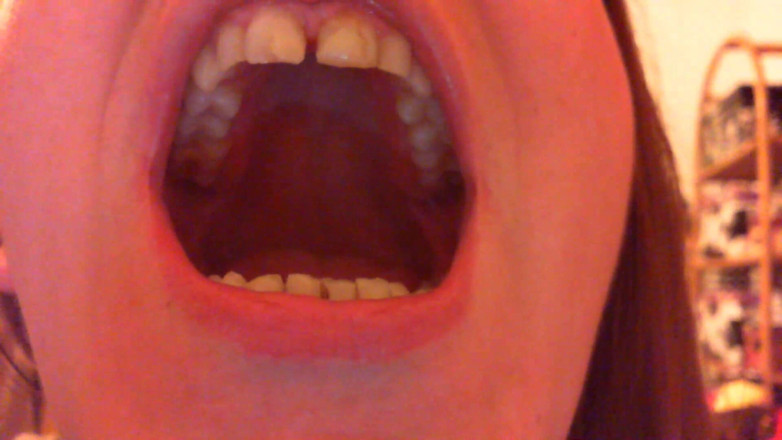 Nicoletta Embassi: Teeth Fetish Devour