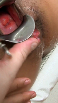 Exl-013: Huge Stretched Loose Pussy Hole Cervix View Speculum in Ass Maria Caldas - Full Scene Extremelatina Exl-013