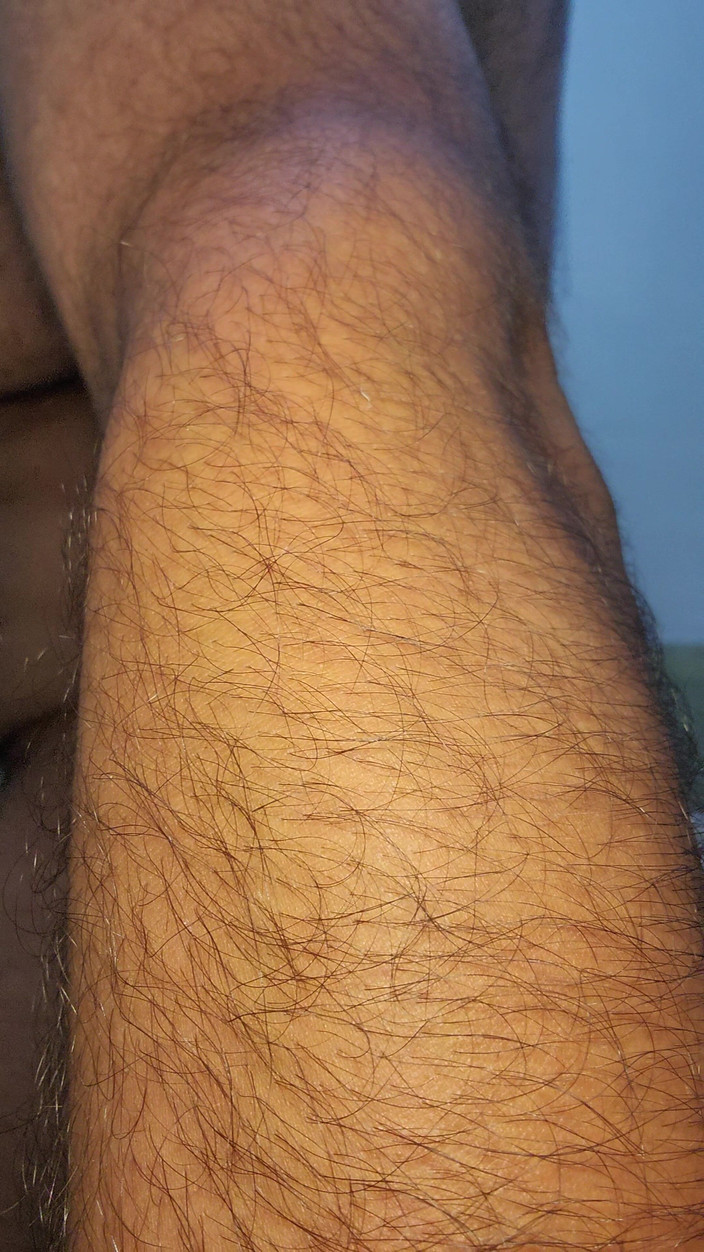 stoned boy: New Angle