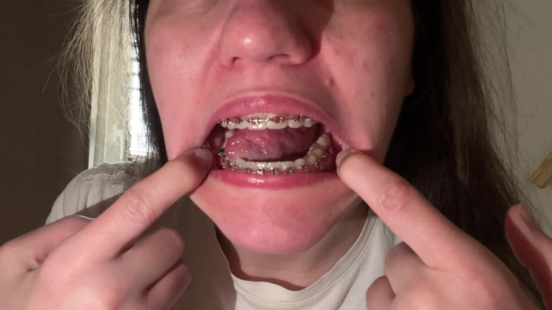 NicoleRay: Menjilati kawat gigi dengan lidah Anda