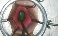 Sticking the Huge Dildo in My Broken Ass
